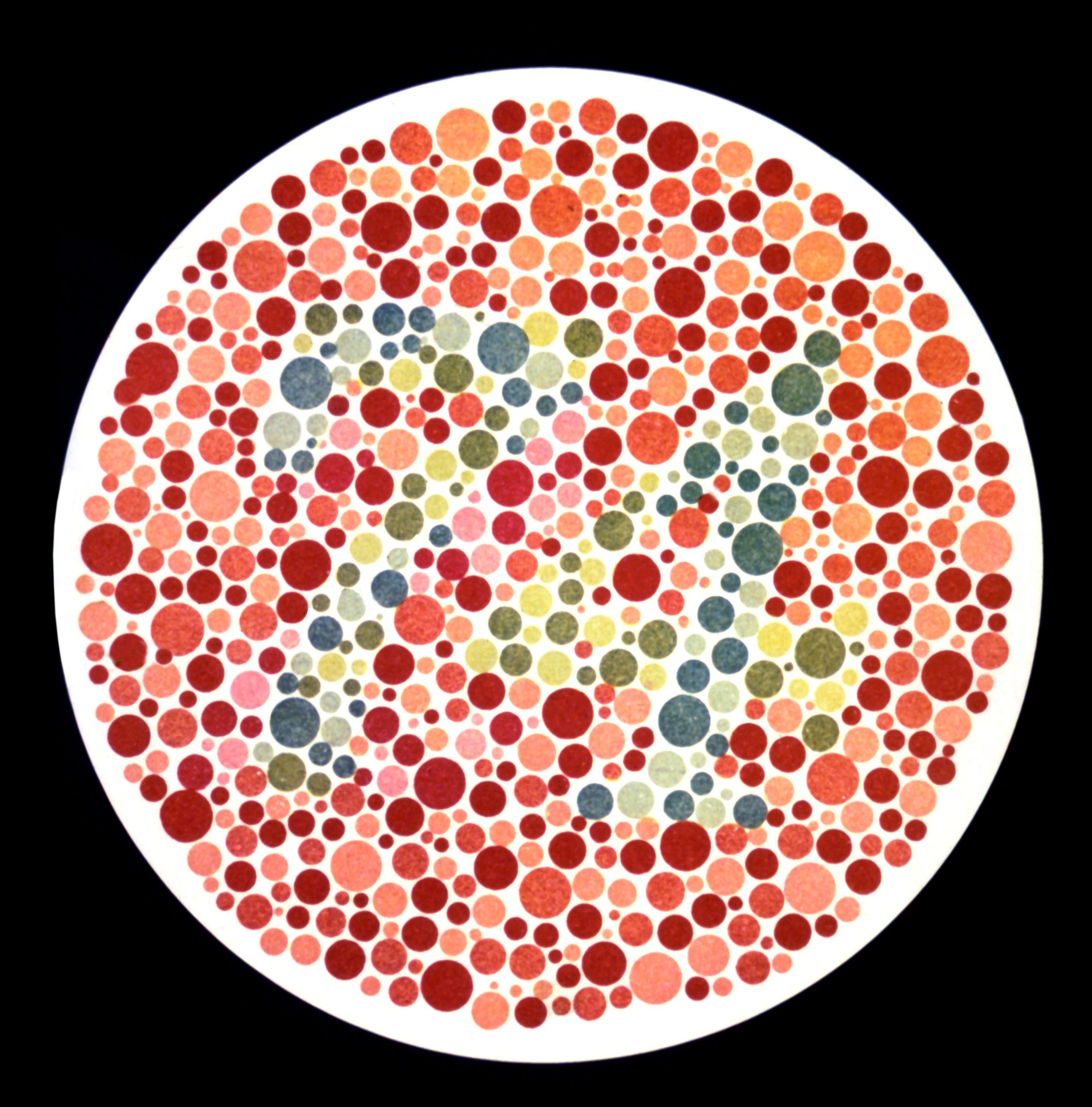Color Blindness Insights: Embracing Differences in Vision