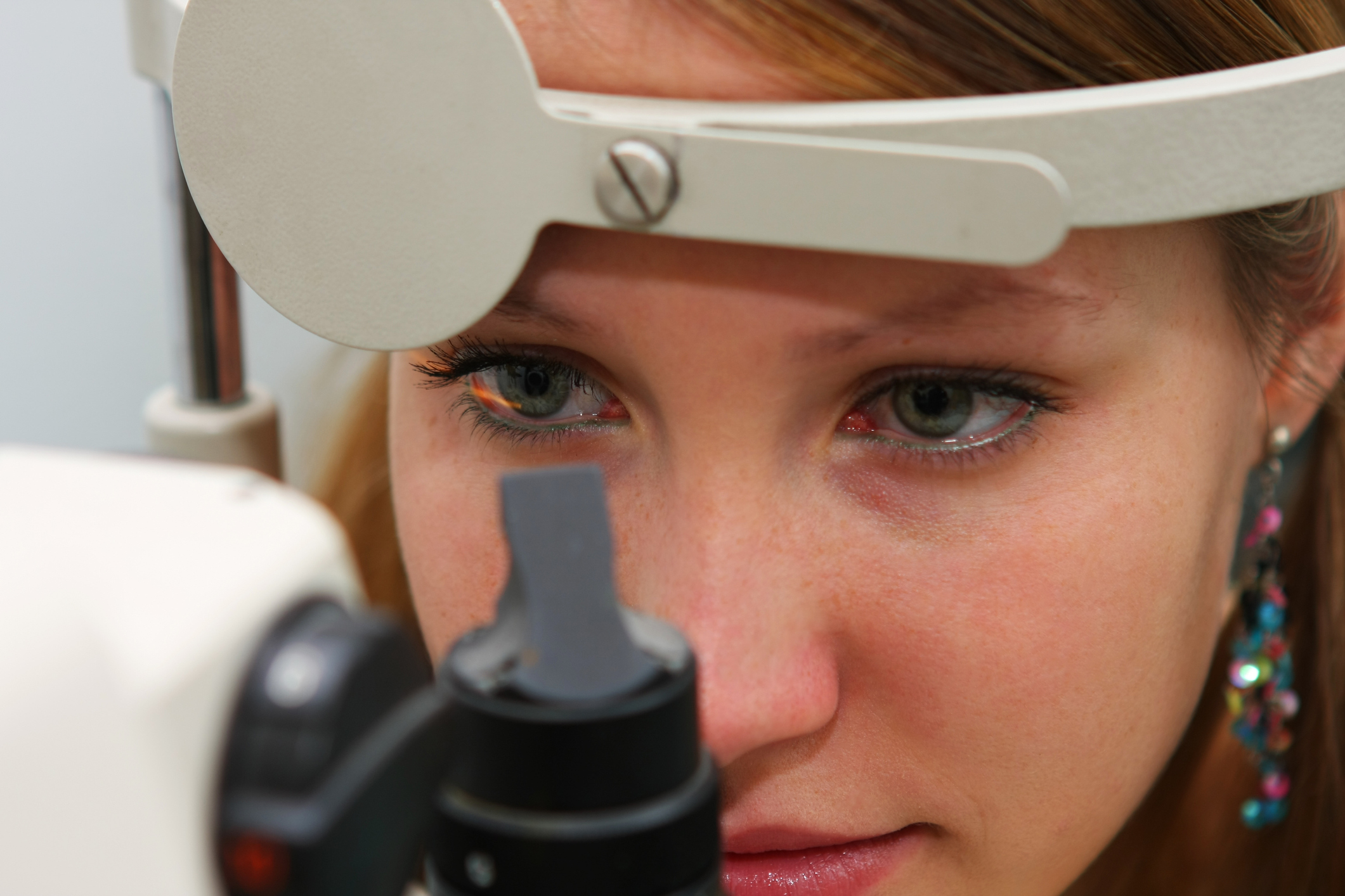 Understanding Herpetic Eye Disease