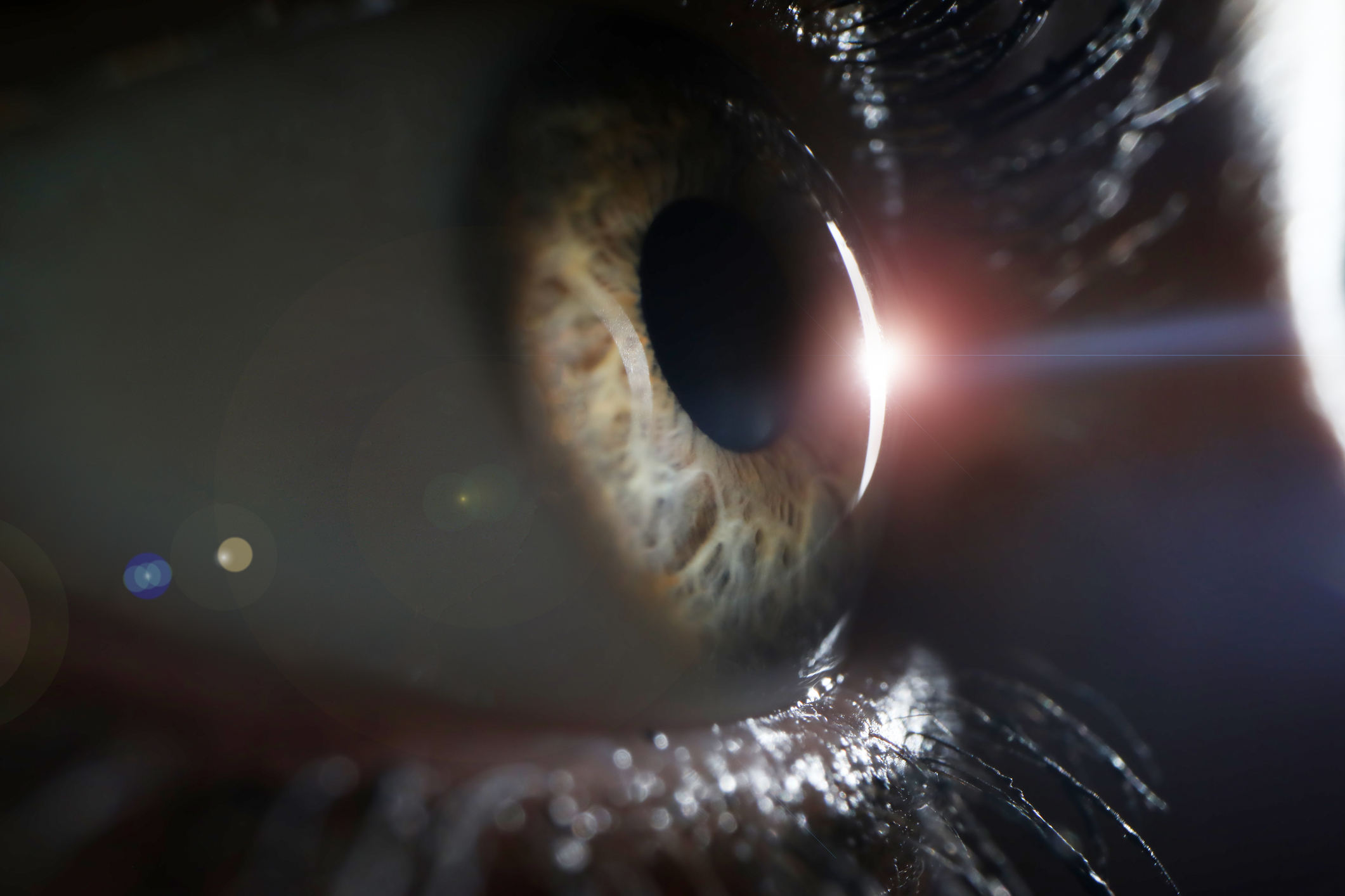 The Optic Nerve: Key to Seeing Things Clearly