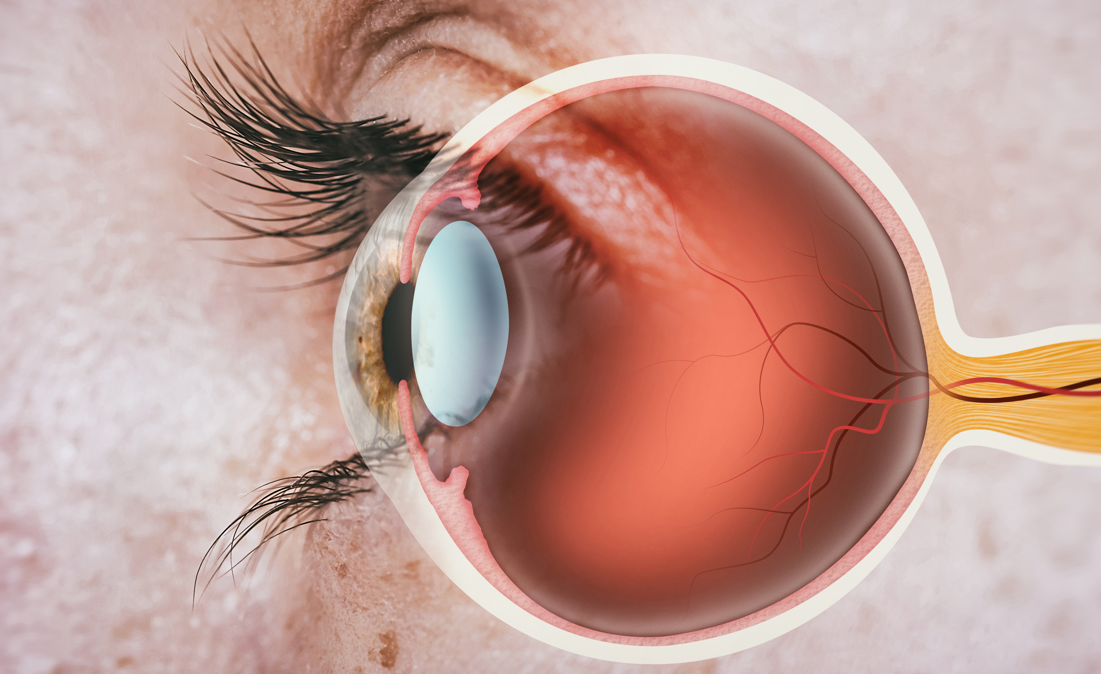 Navigating the Essentials of Retinal Hemorrhage