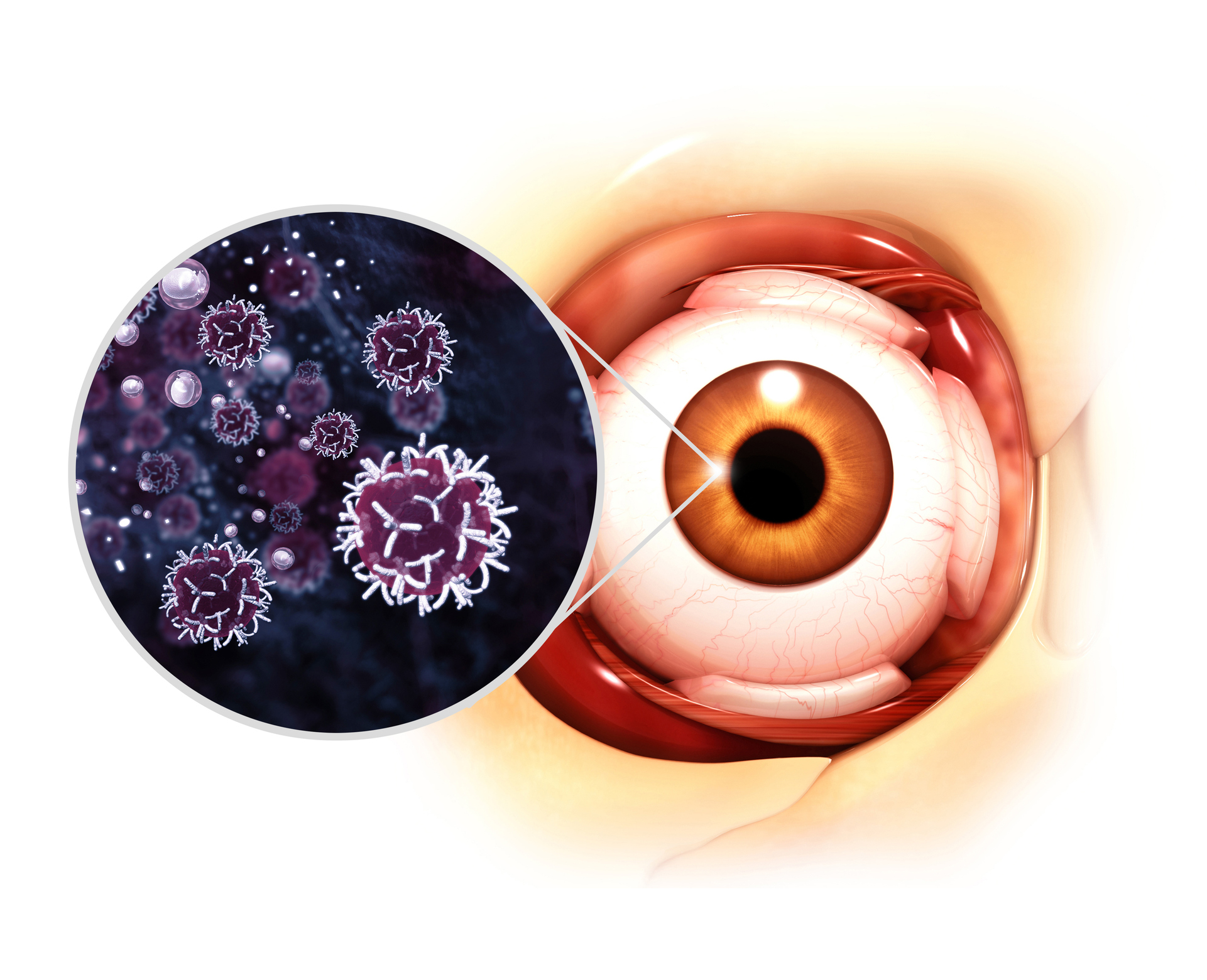 Understanding Proptosis: Bulging Eyes