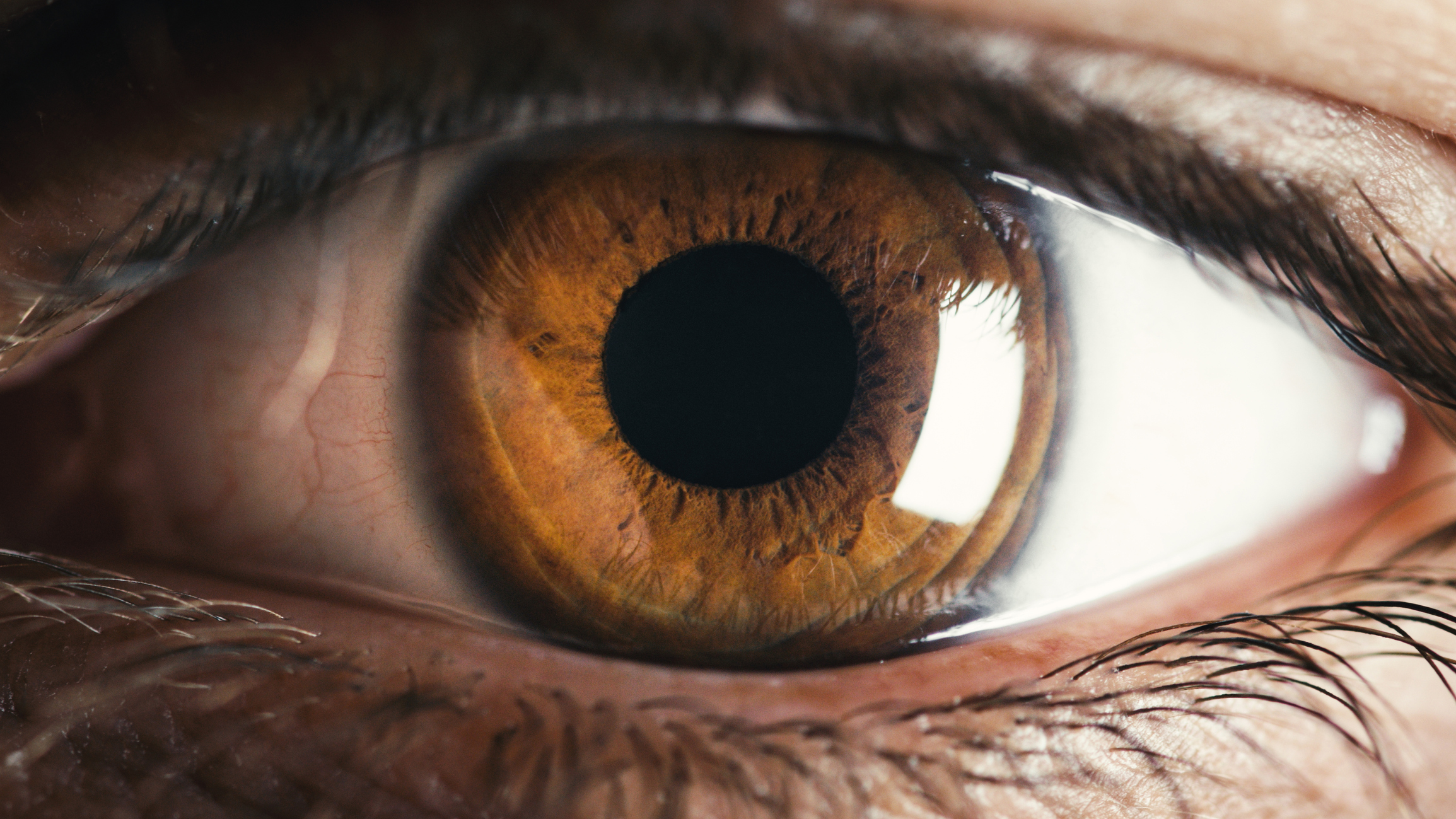 Understanding Brown Syndrome - World Eye Care Foundation