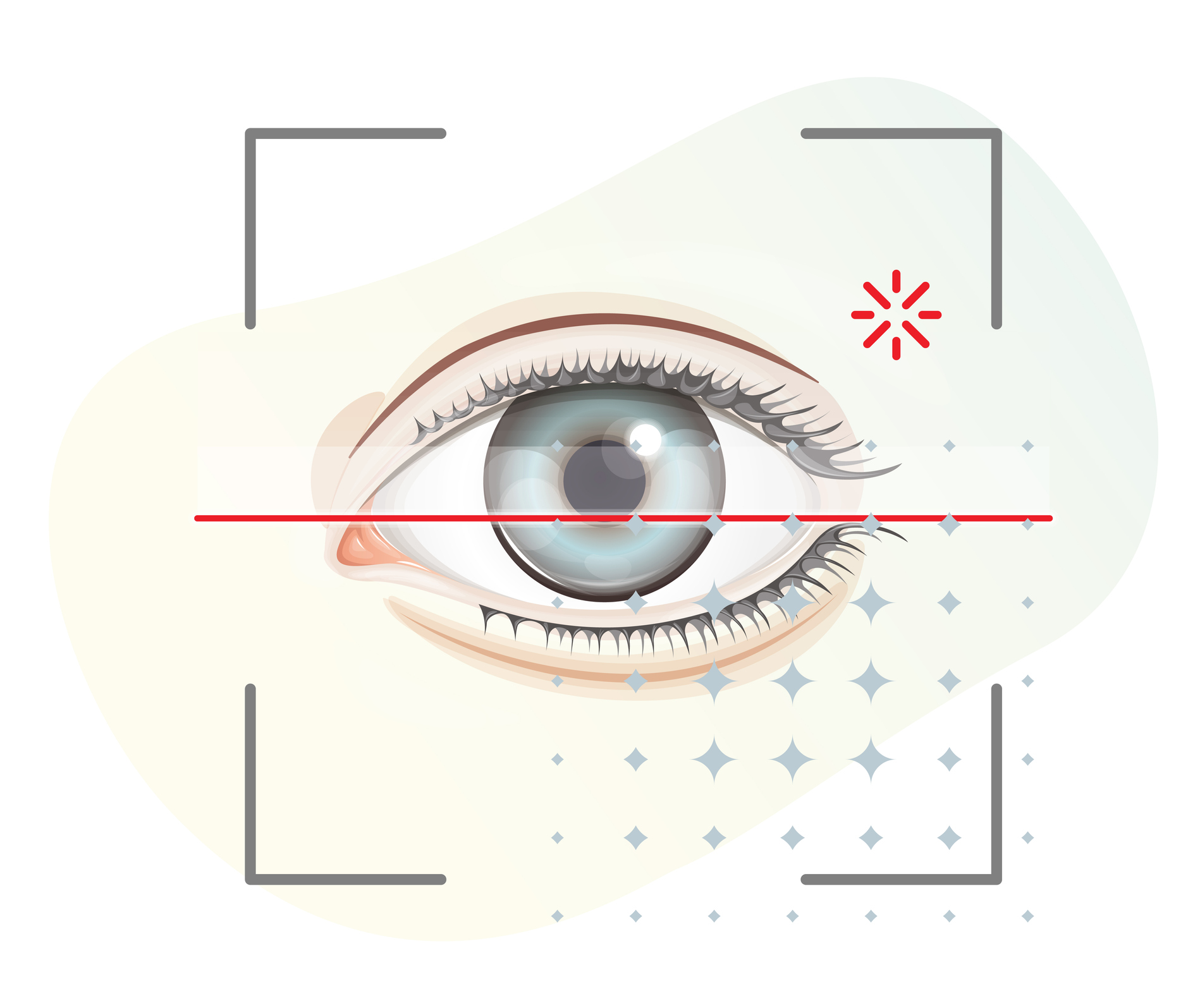 Angle-Closure Glaucoma: Causes, Symptoms, And Treatment