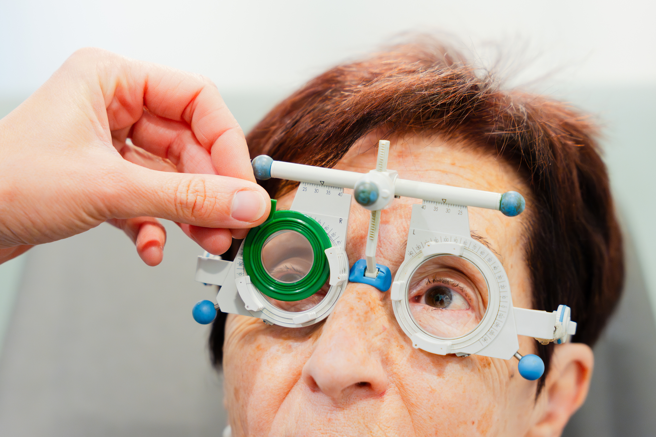 Iridodialysis: Understanding the Causes and Effects on Eye Health
