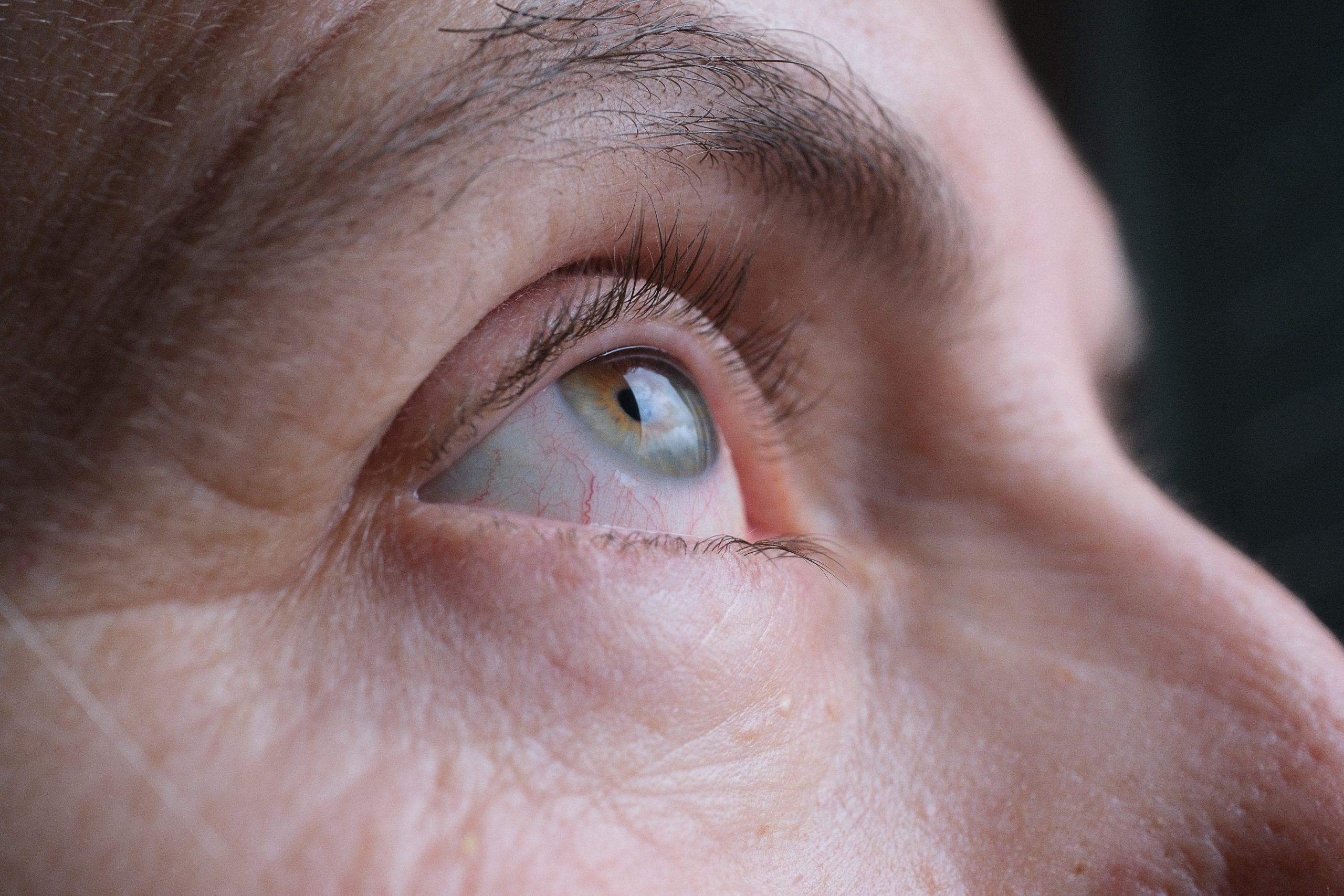 Sjögren’s Syndrome Unveiled: Causes, Symptoms - World Eye Care Foundation