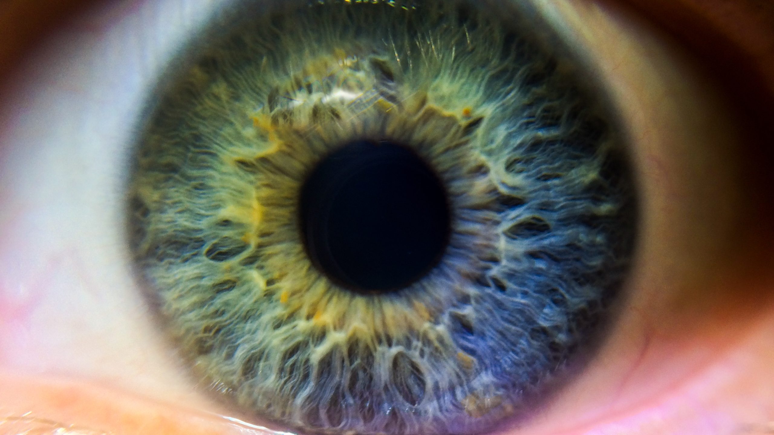 Discovering the Beauty of the Iris: Protector of Your Eyesight