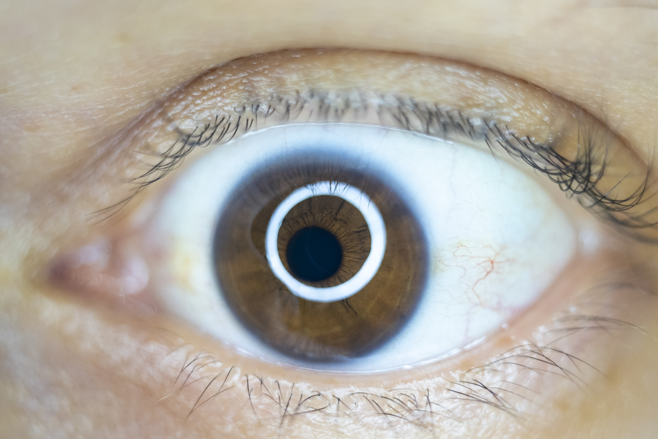 Understanding Eye Discharge: Causes, Symptoms, and Treatment