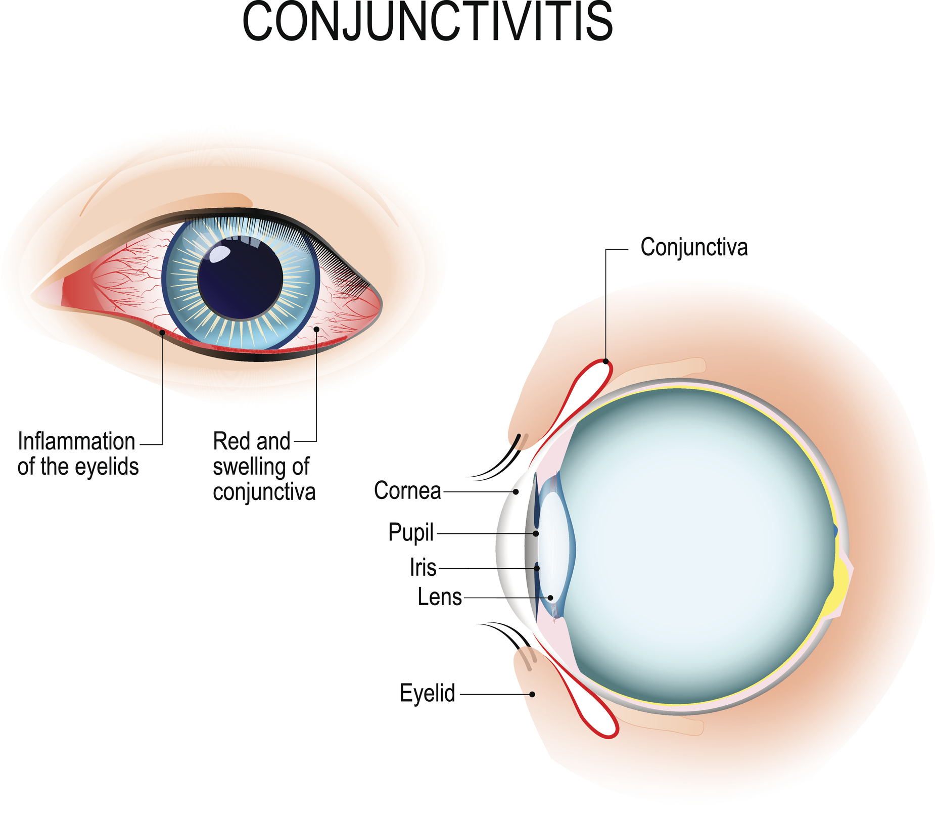 Unveiling the Conjunctiva: Your Eye's Guardian