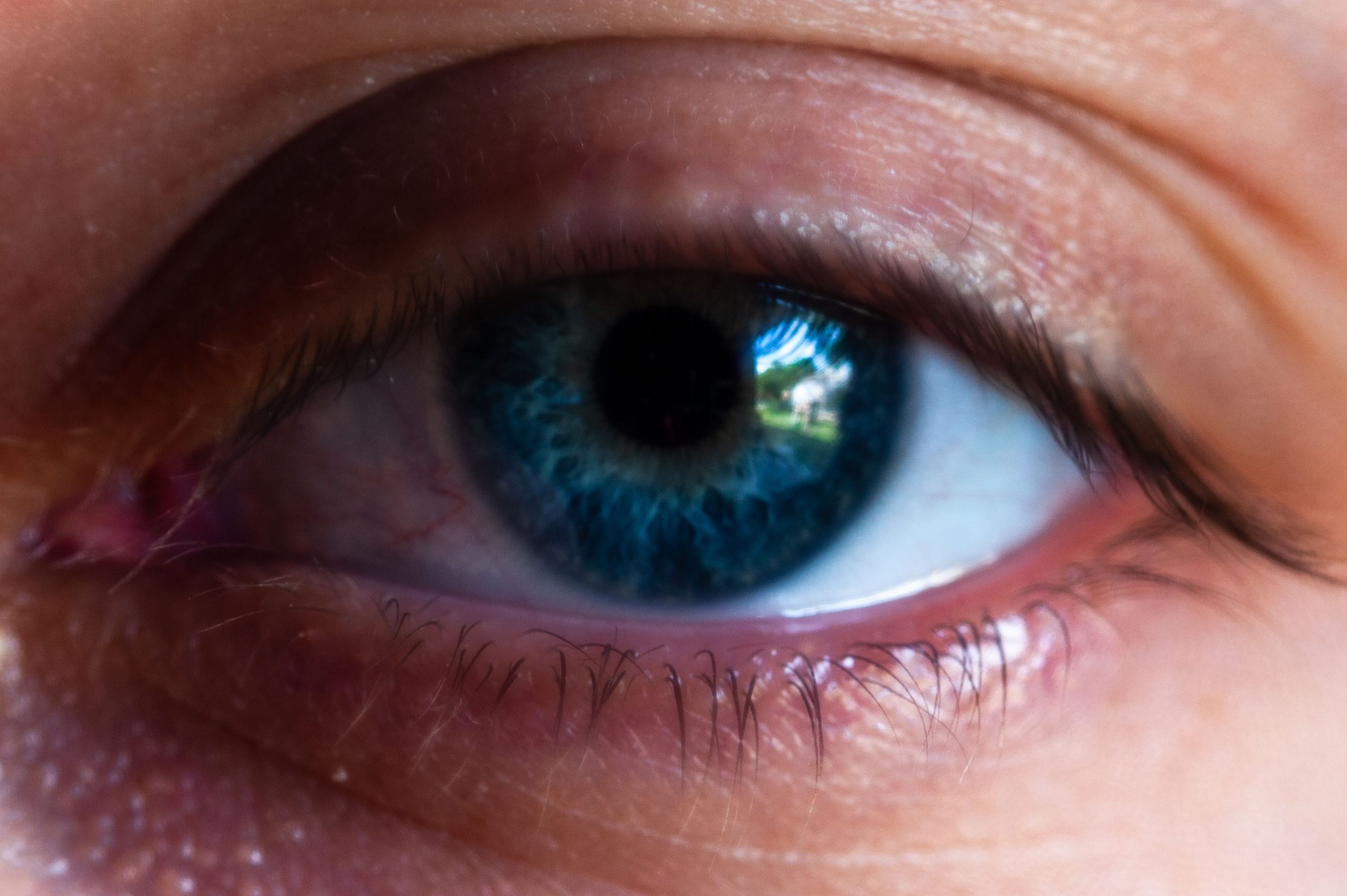 Exploring EMDR Therapy: Eye Movement Desensitization and Reprocessing