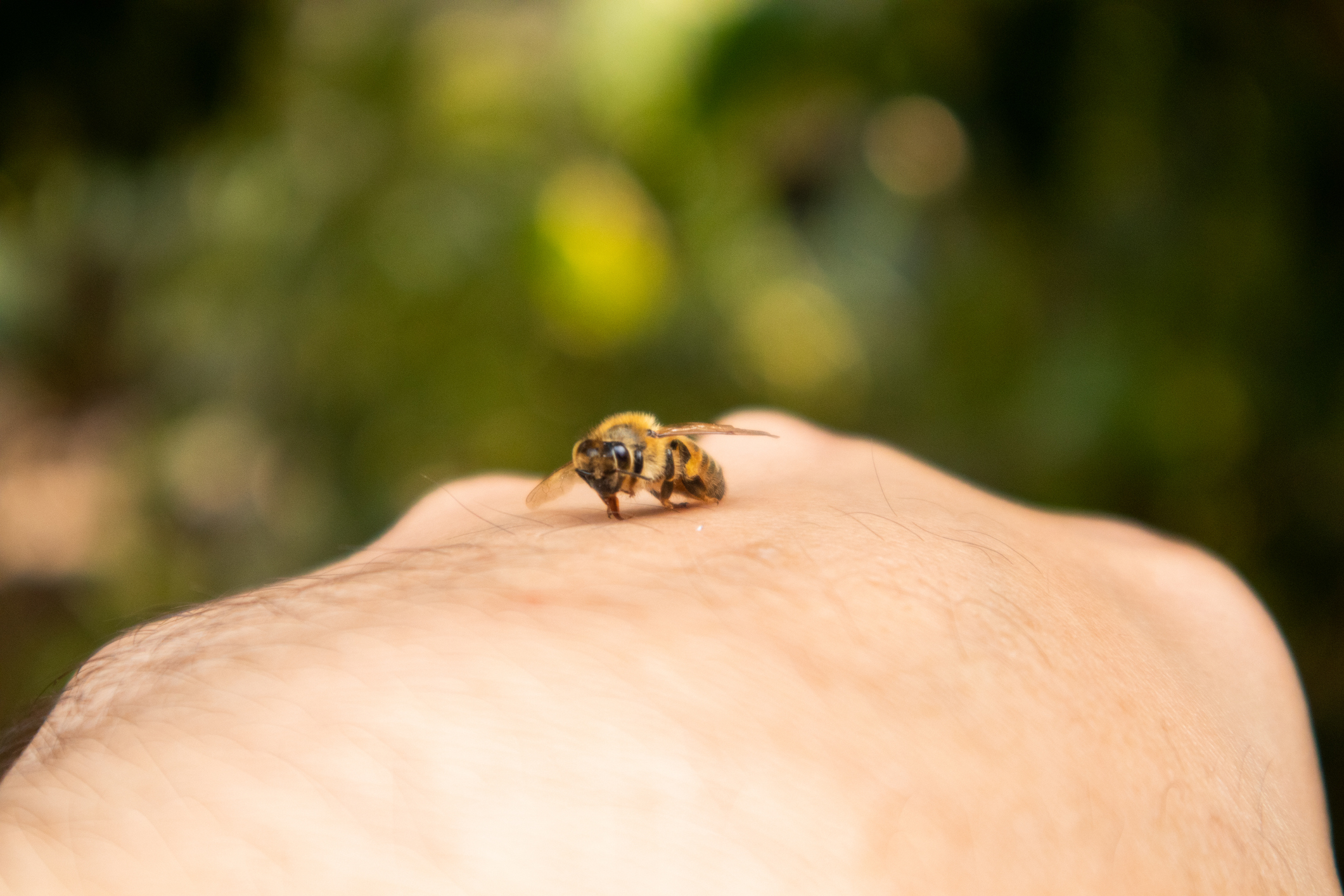 How to Treat a Bee Sting Near the Eye