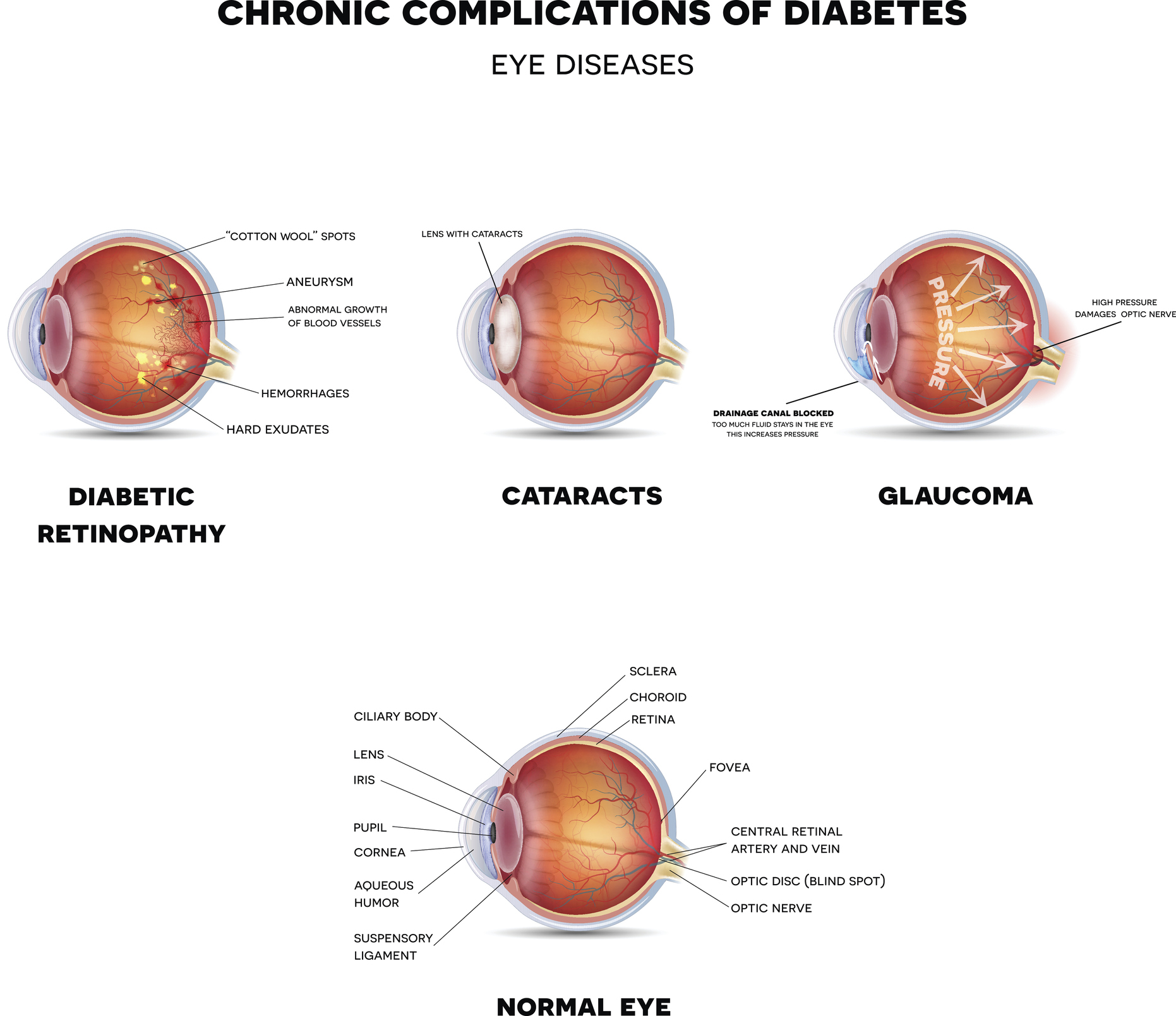 Autonomous artificial intelligence increases screening and follow-up for diabetic retinopathy in youth: the ACCESS randomized control trial