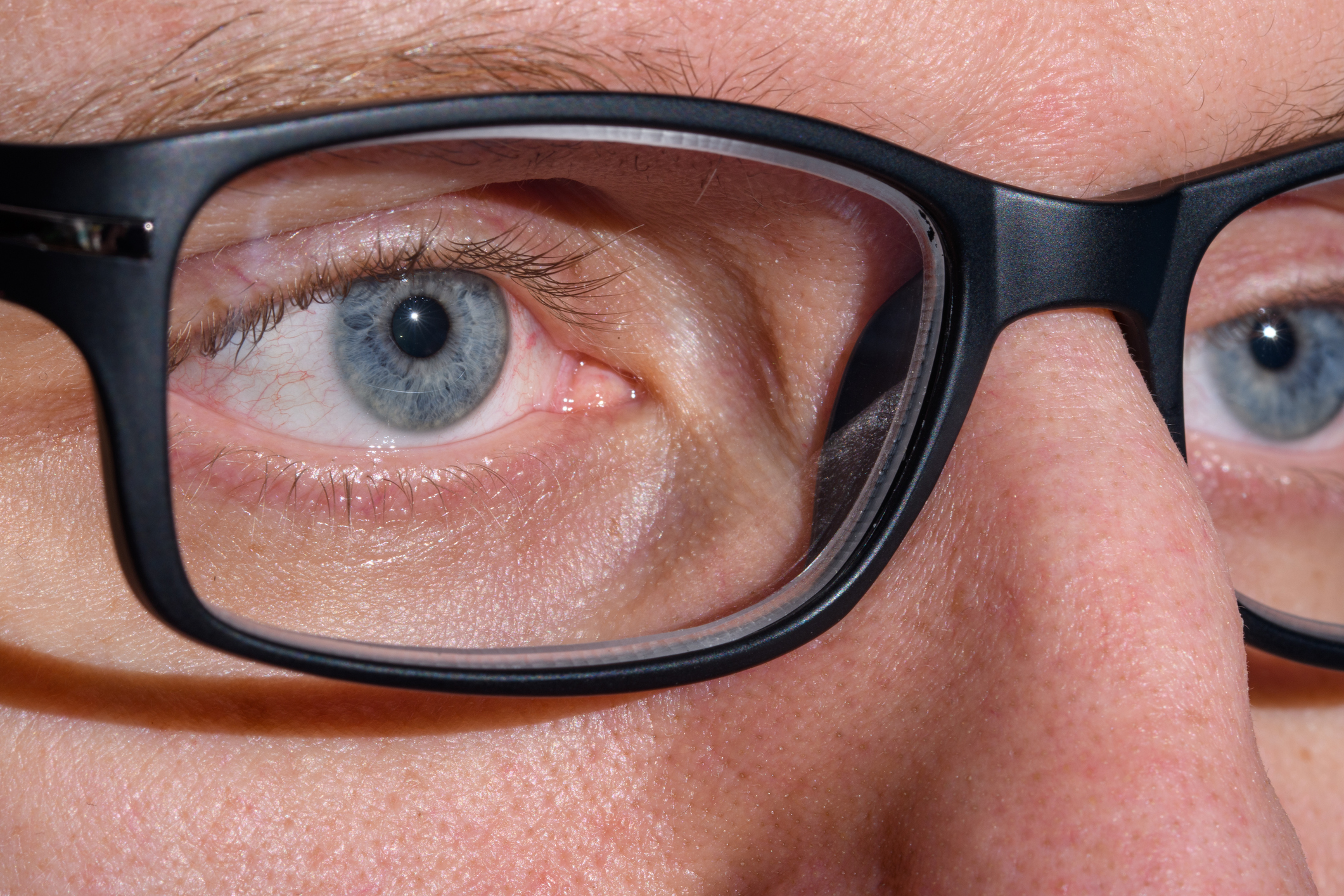 Cortical Visual Impairment: Understanding Brain-Based Vision Loss