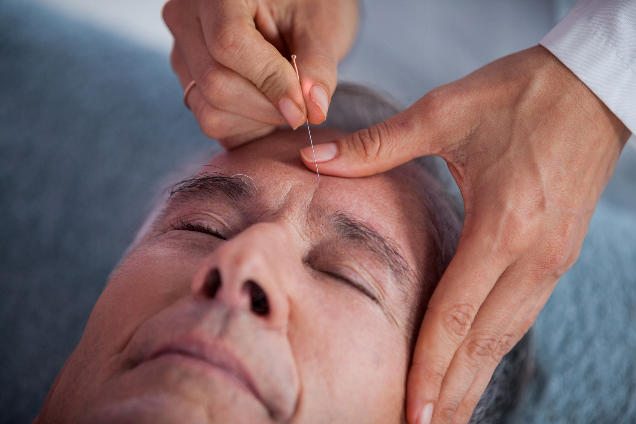 Exploring the Benefits of Acupuncture for Eye Health