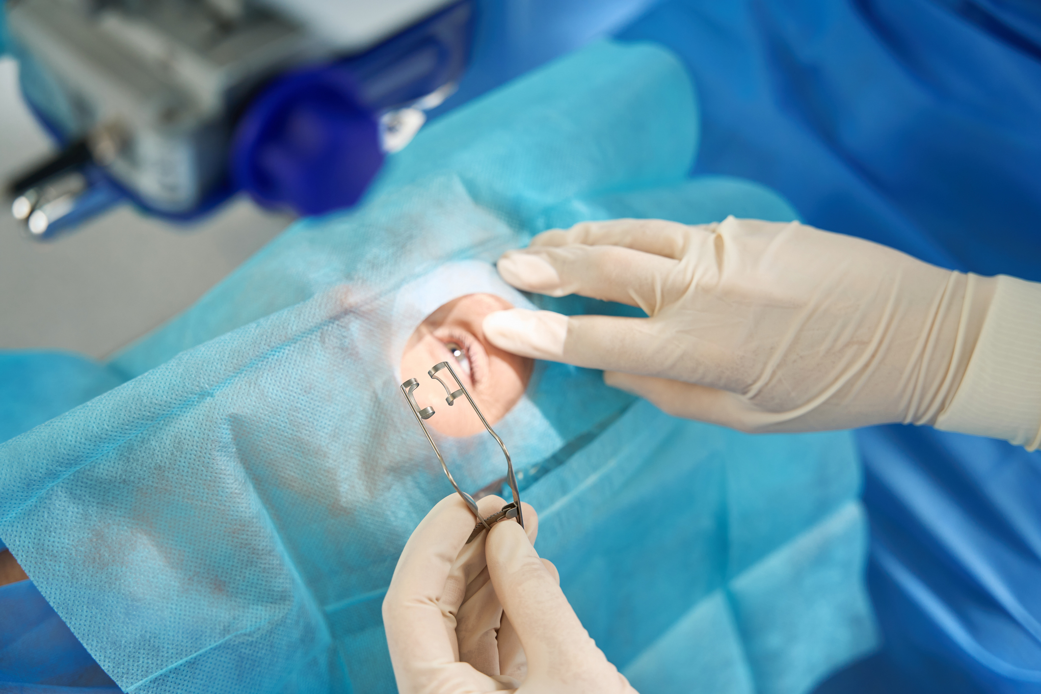 Scleral Buckling Surgery for Retinal Detachment Repair