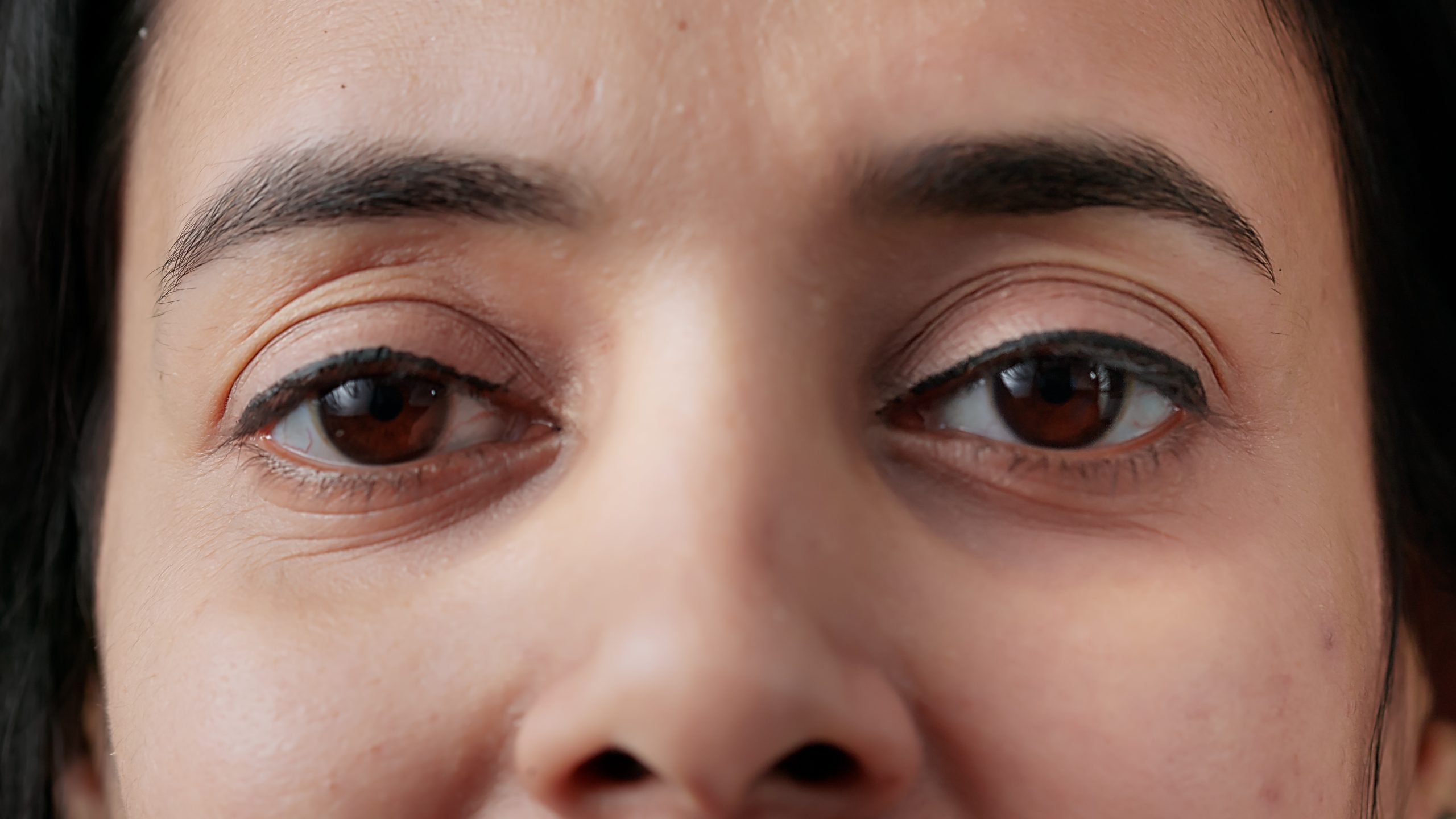Toxoplasmosis and Ocular Involvement