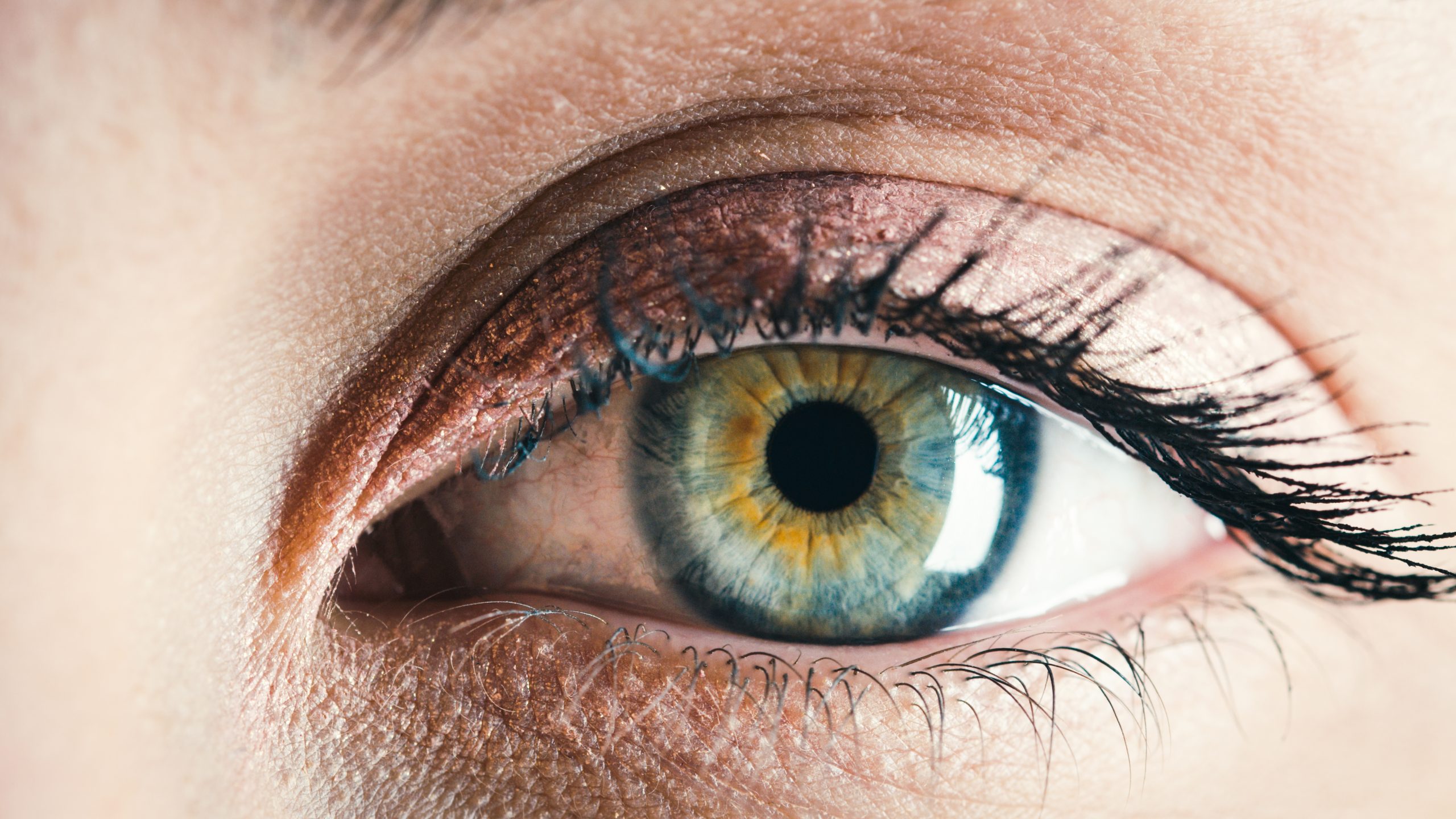 Understanding the Impact of Alport Syndrome on Ocular Health