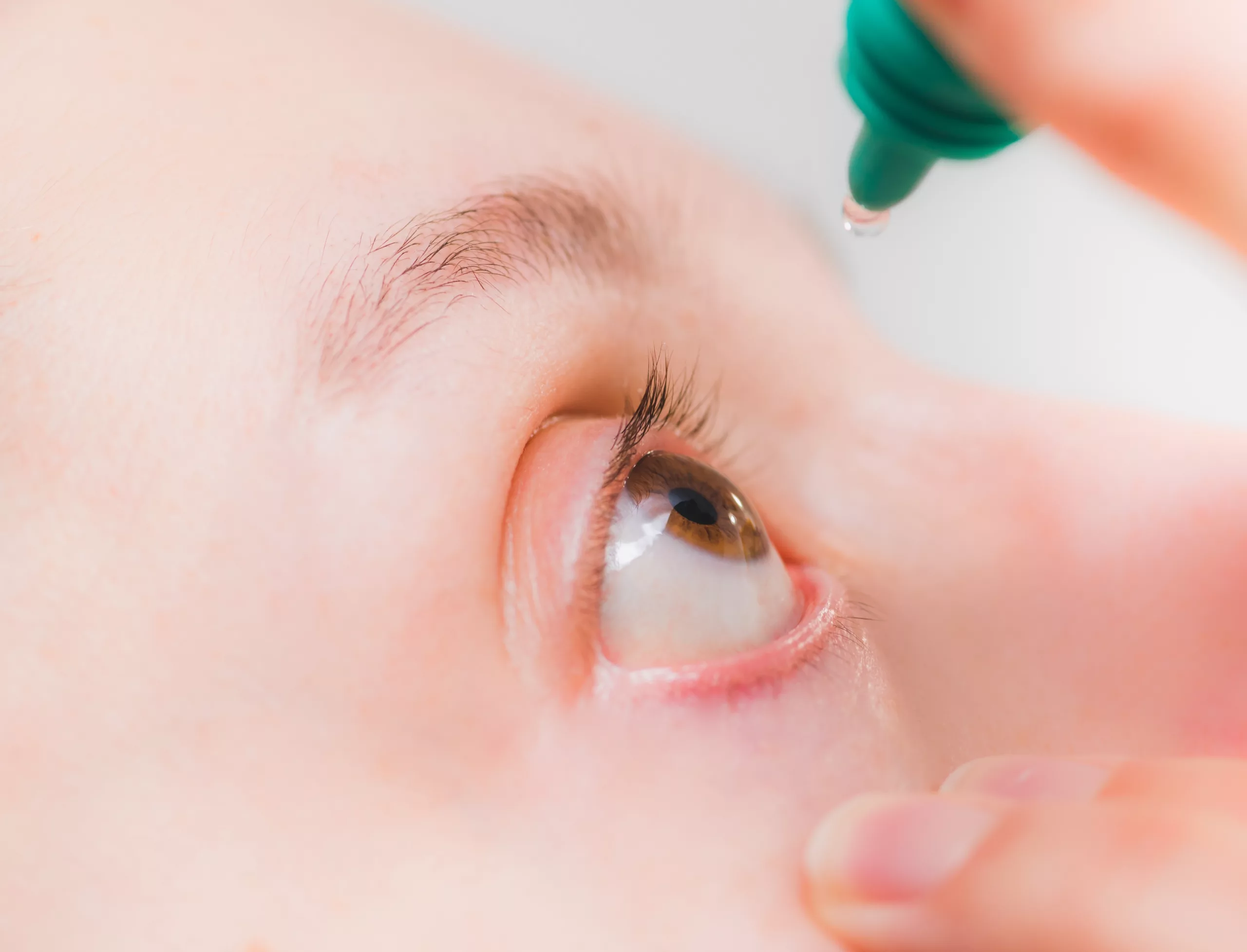 Demystifying Wet AMD Injections