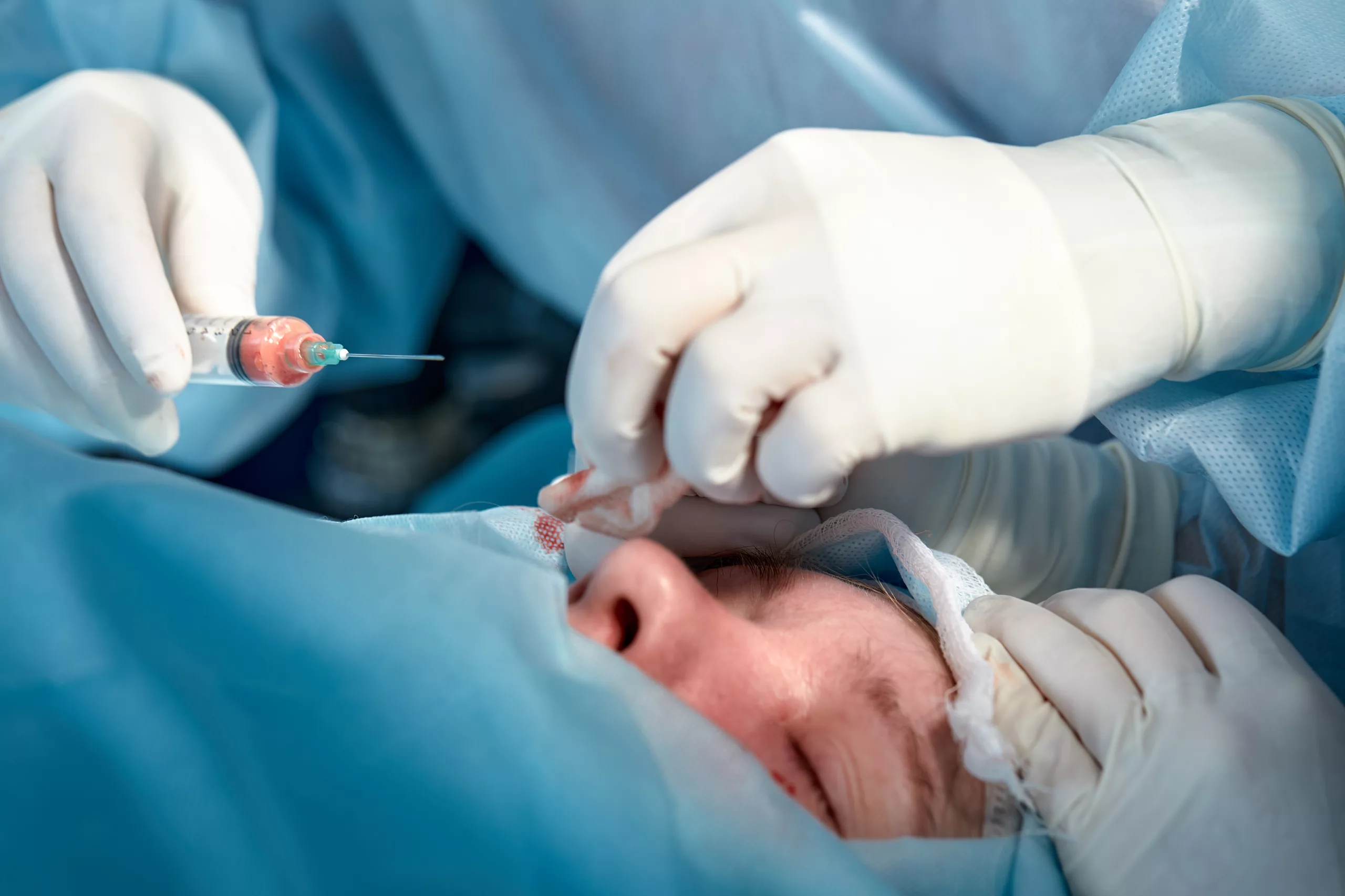 A Comprehensive Guide to Tear Duct Probing Surgery