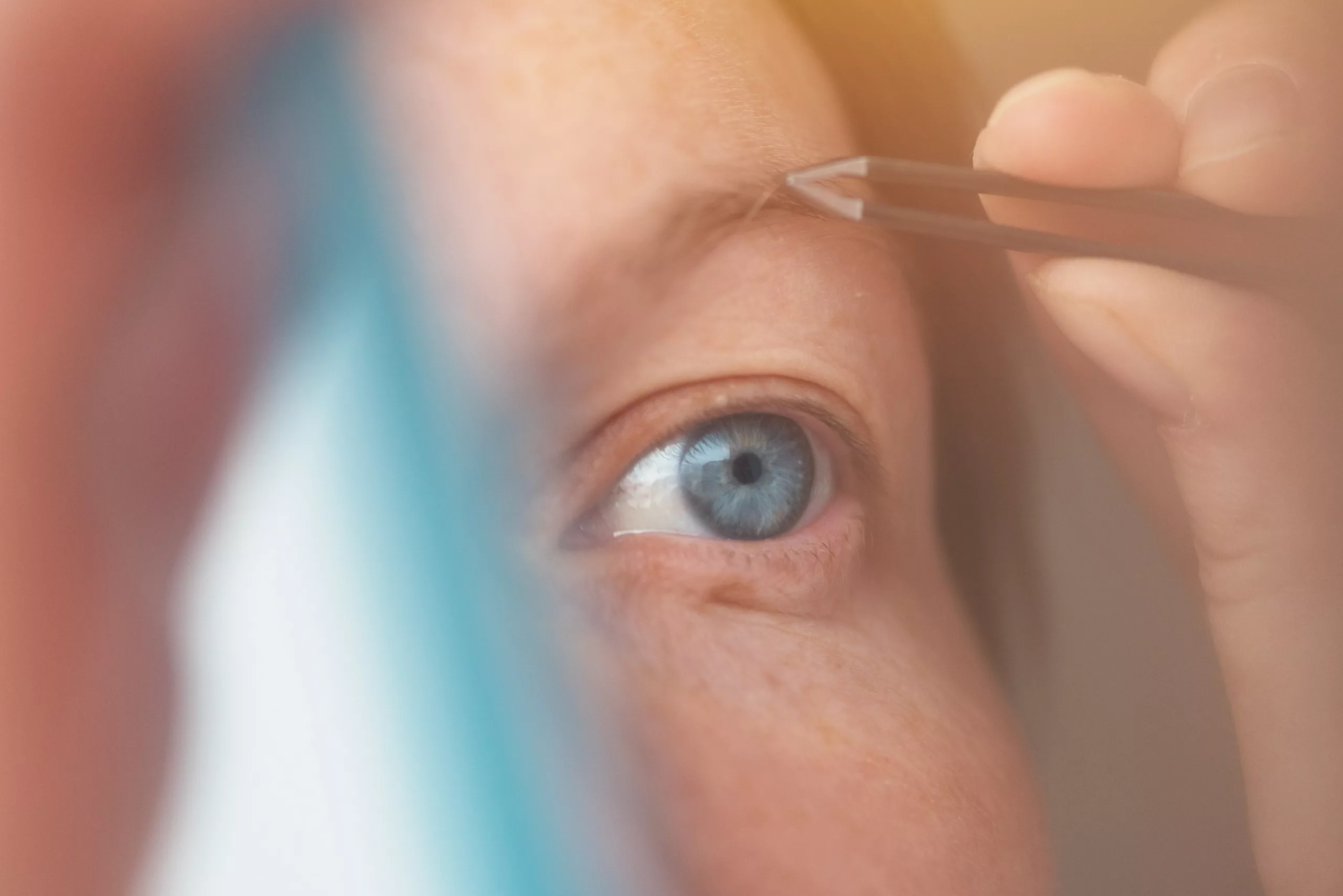 Iris Suture Fixation: Ensuring Stability and Visual Clarity