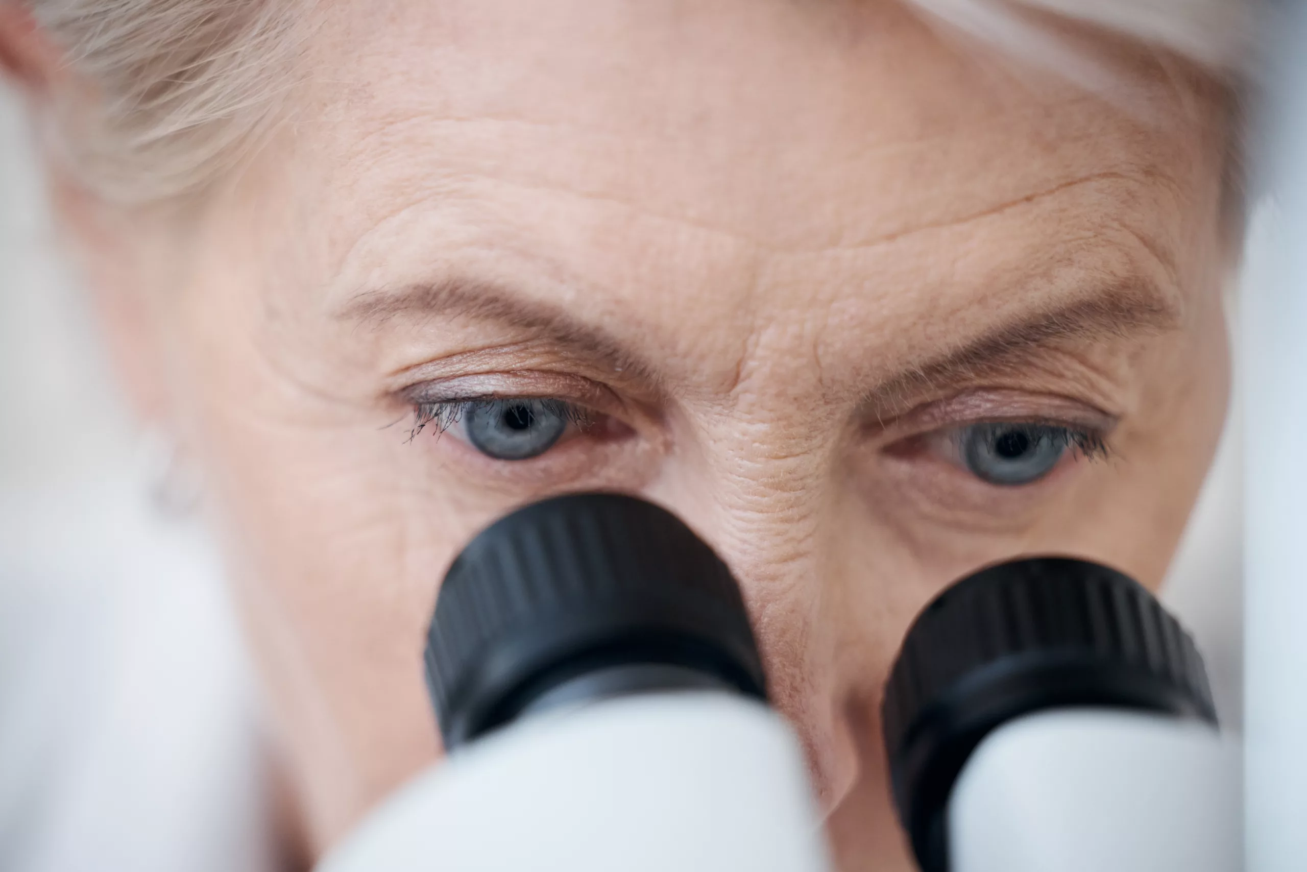 Why Alzheimer’s Disease is Visible in the Eyes