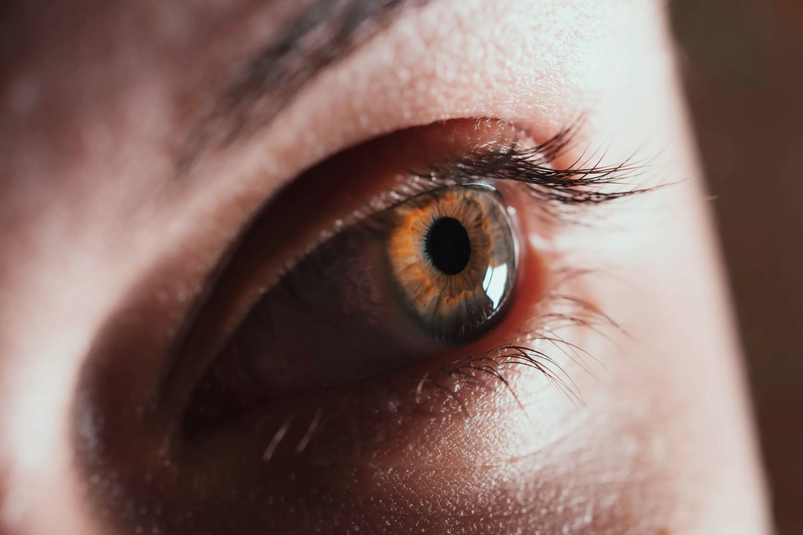 What is Traumatic Eyeball Luxation?