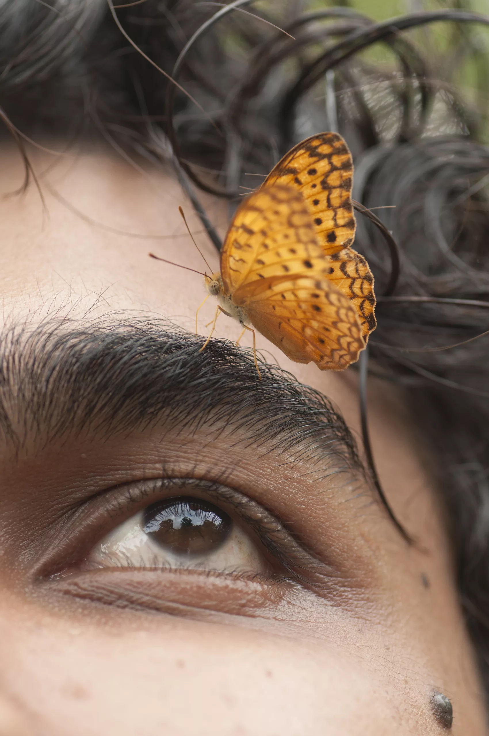 How Metamorphopsia (Distorted Vision) Affects Your Sight: Causes, Diagnosis, and Treatment