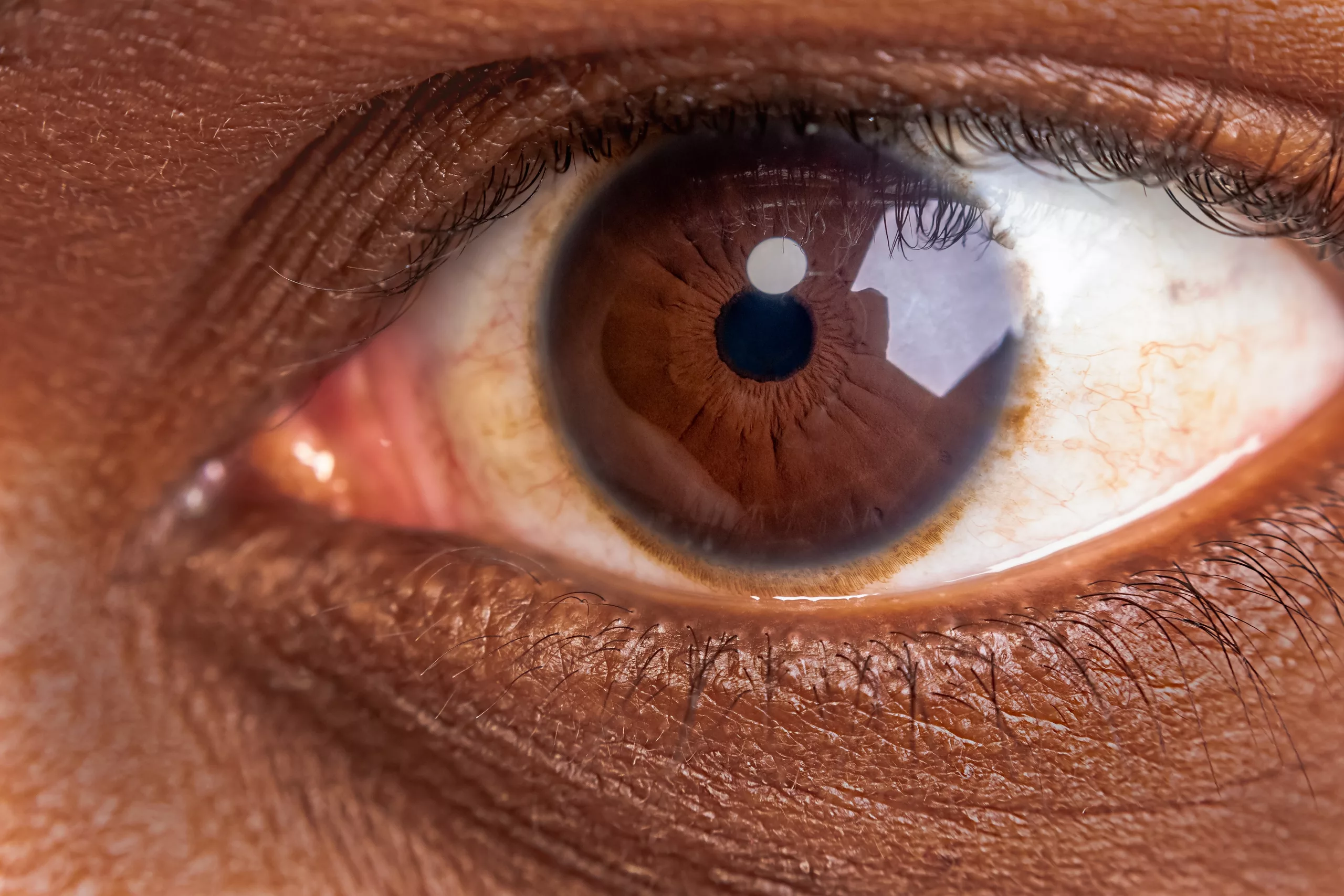 Understanding Monolid Eyes: Anatomy, Aesthetics, and Care