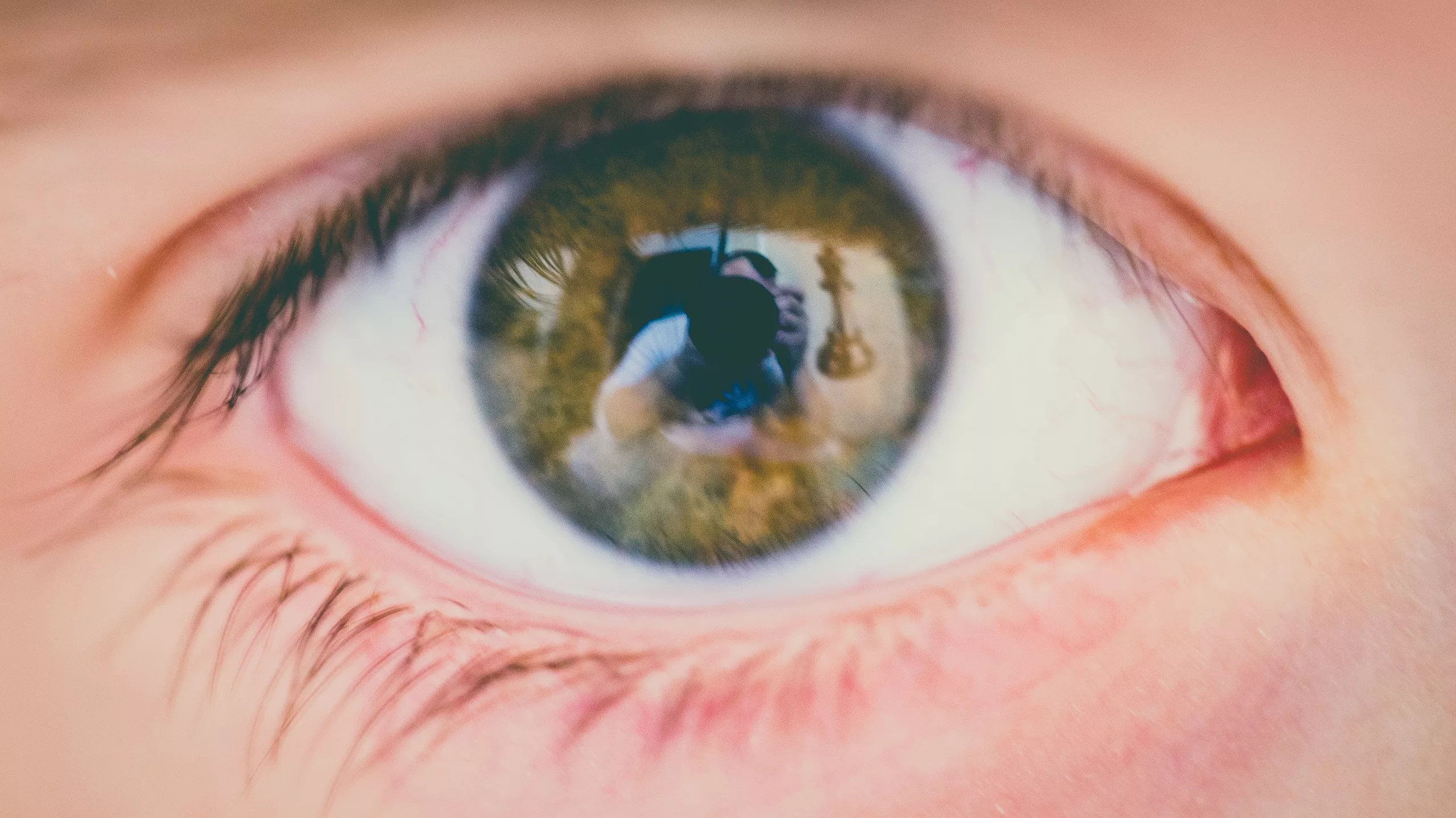 Fabry Eye Disease: Understanding Its Impact on Vision